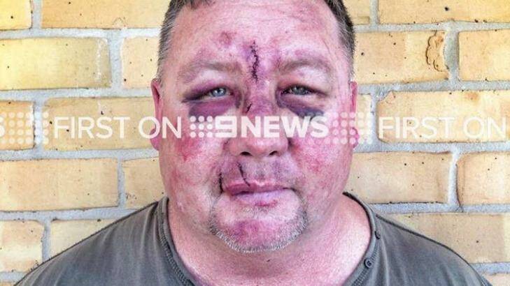 "Paul" was bashed on the way home from a football game. Photo: Mitch Wall, 9NEWS